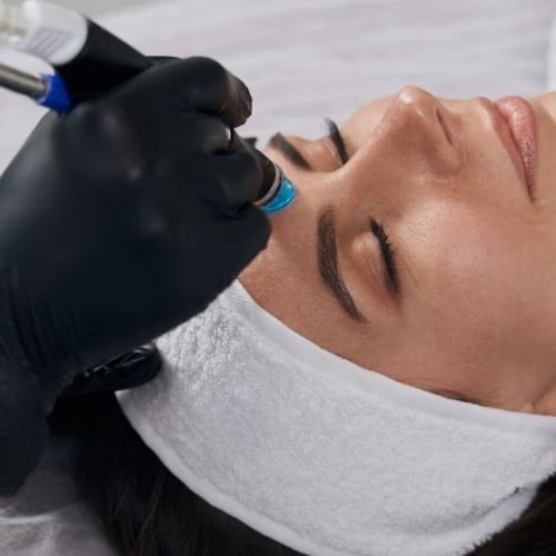 Microdermabrasion-Behandlung